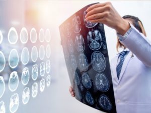 Can a Traumatic Brain Injury Cause ADHD
