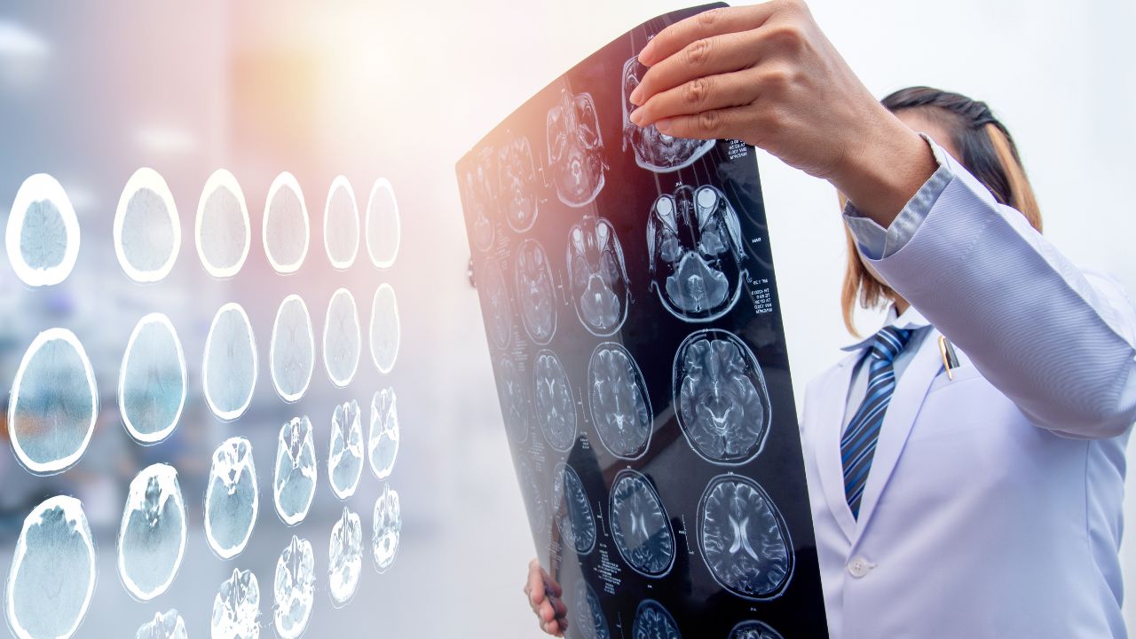 a picture of a doctor holding and reading a brain injury scan result