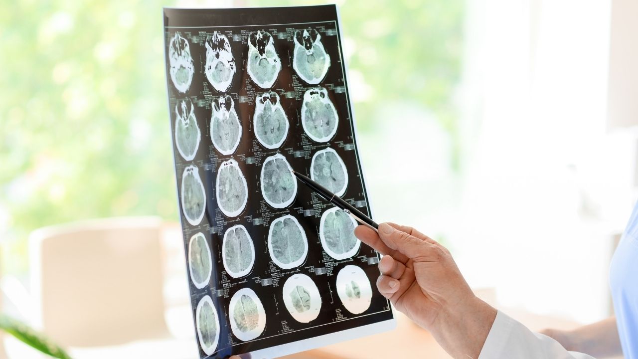 Michigan Brain Injury Attorney